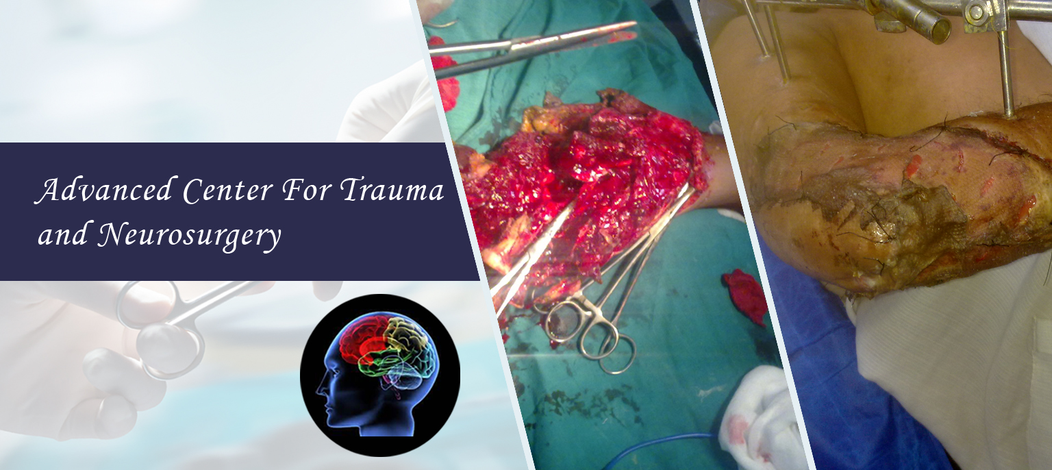trauma-and-neurosurgery